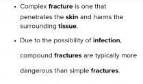 A fractured clavicle is....